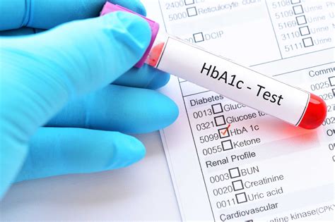 HbA1c test .